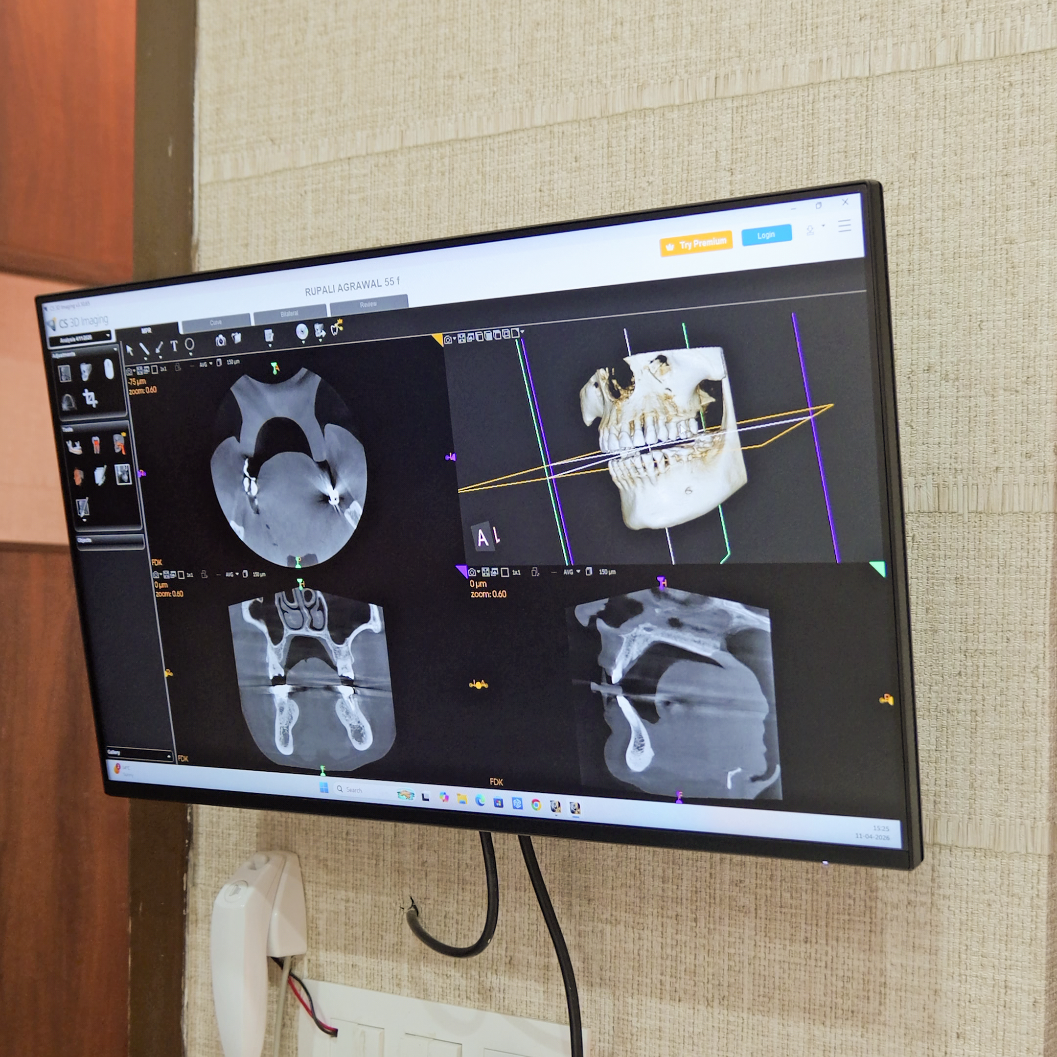 Dental implant surgical kit in Powai Mumbai for implant procedures