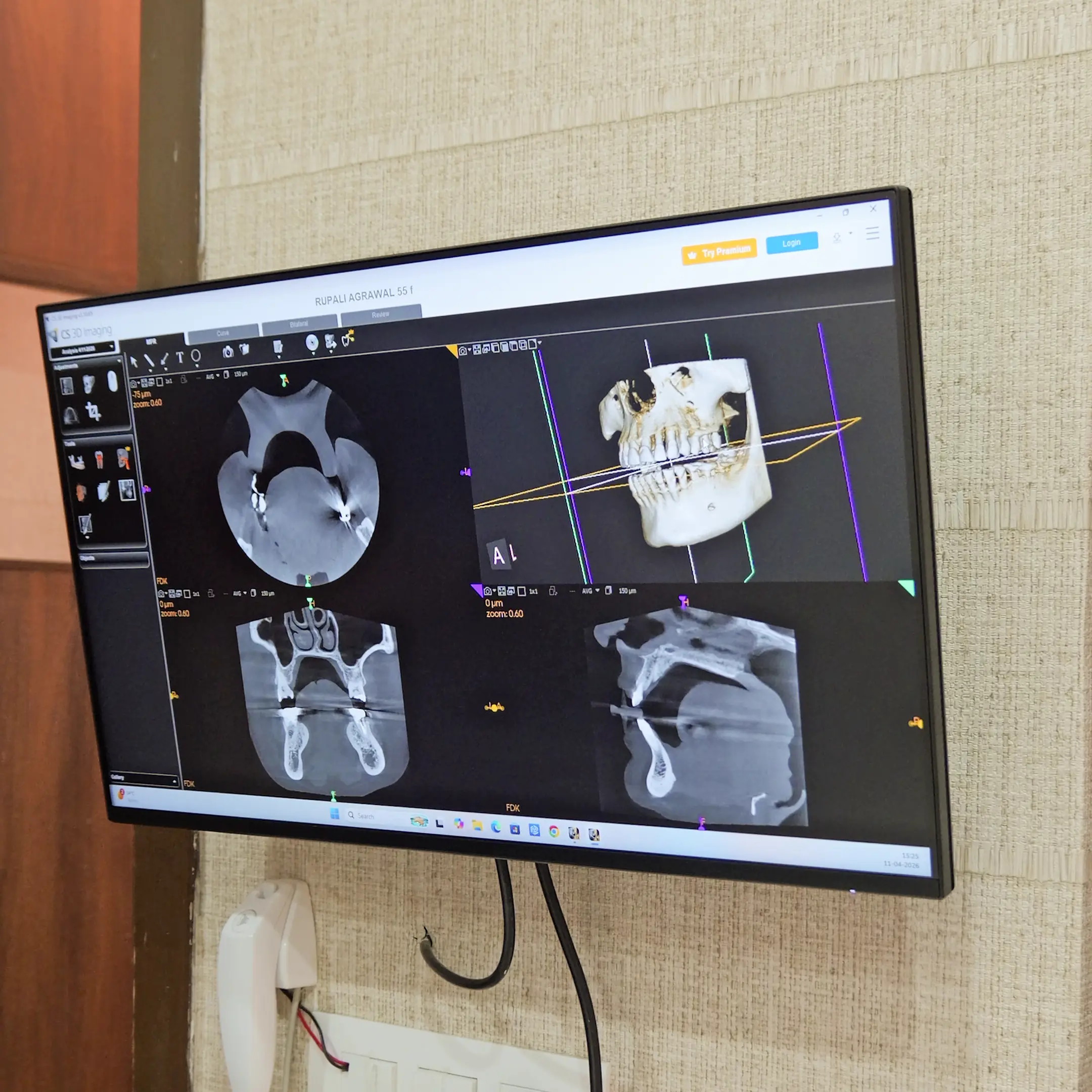 Dental implant surgical kit in Powai Mumbai for implant procedures