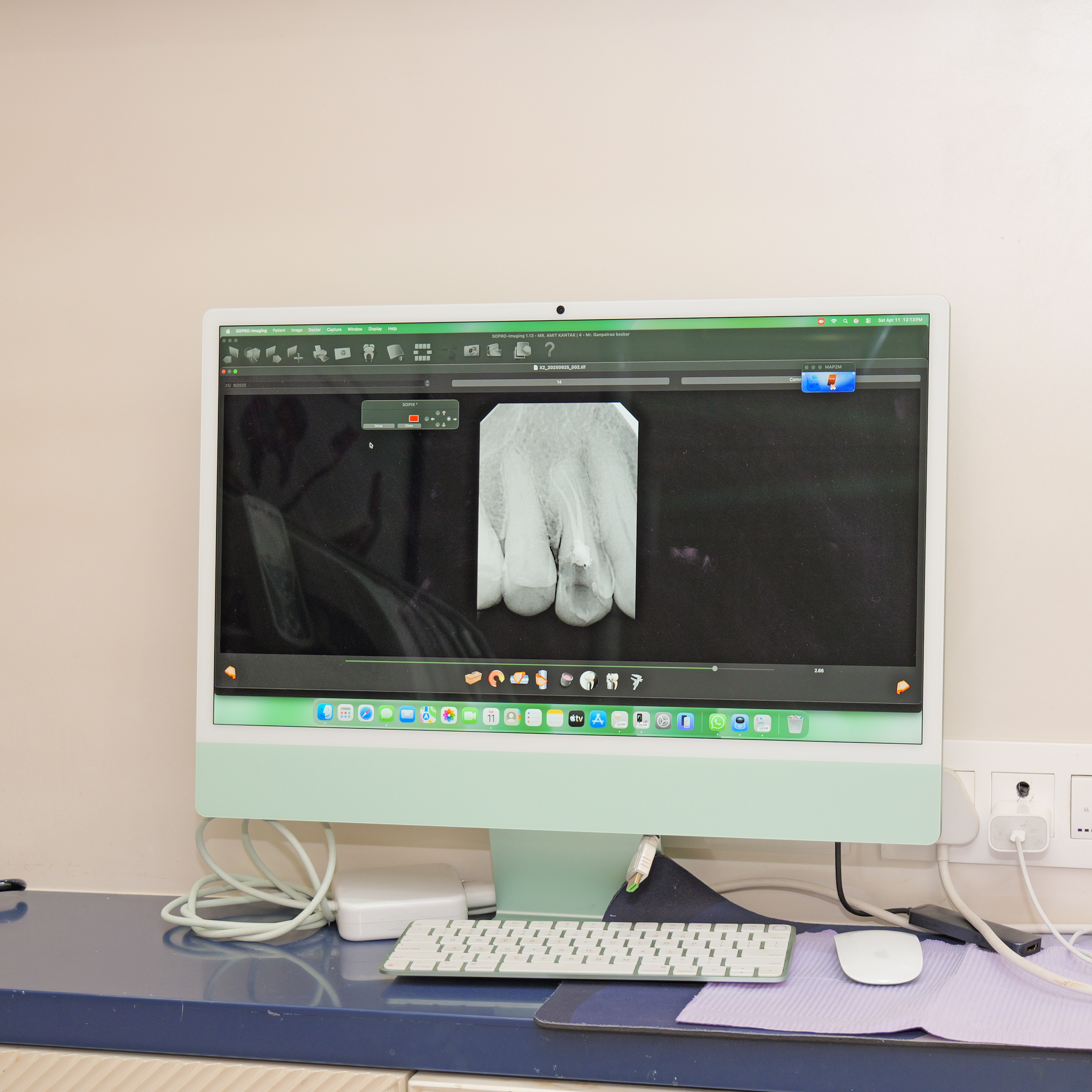 Dental suction system in Powai Mumbai clinic for saliva control during treatment